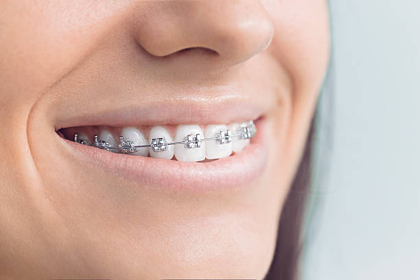 Best Dental Fillings (Composite and Amalgam)  in Rutgers University Livingston Campus, NJ